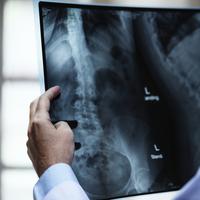 male physician holding up a back xray